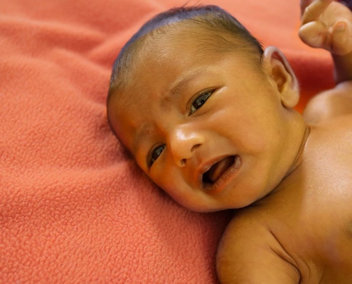 ¿Por qué el bebé tiene ictericia?, ¿Cómo se diagnostica la ictericia?